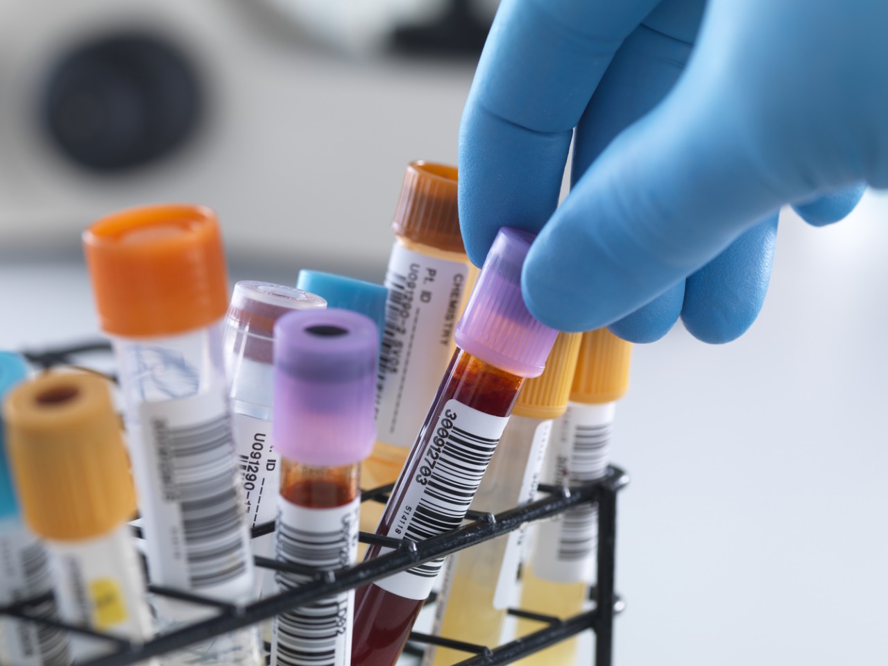 “溶出”还是“BE”，何为临床疗效“金标准”