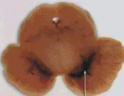 正常人：正：谥