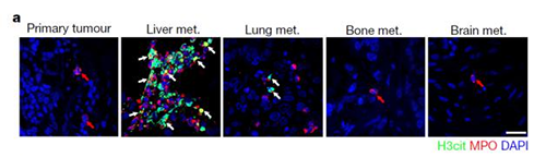 转入小鼠模型得到相同的试验结果，且在转移发生前NET已在肝脏聚积。