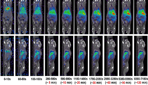 不朽情缘mg官网PET/CT分子影像技术平台