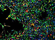 世界首创：药物将干细胞引导至受损部位，提高其愈合能力！