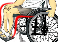 Nature：还瘫痪患者一个自由身的日子不远了