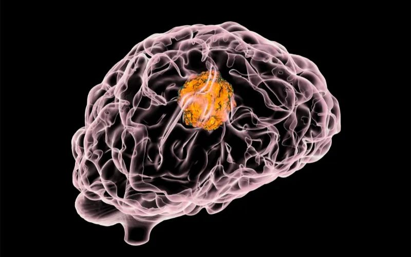 不朽情缘mg官网助力 | 璧辰医药ABM-1310获美国FDA孤儿药资格认证，用于治疗携带BRAF V600突变的脑胶质母细胞瘤患者